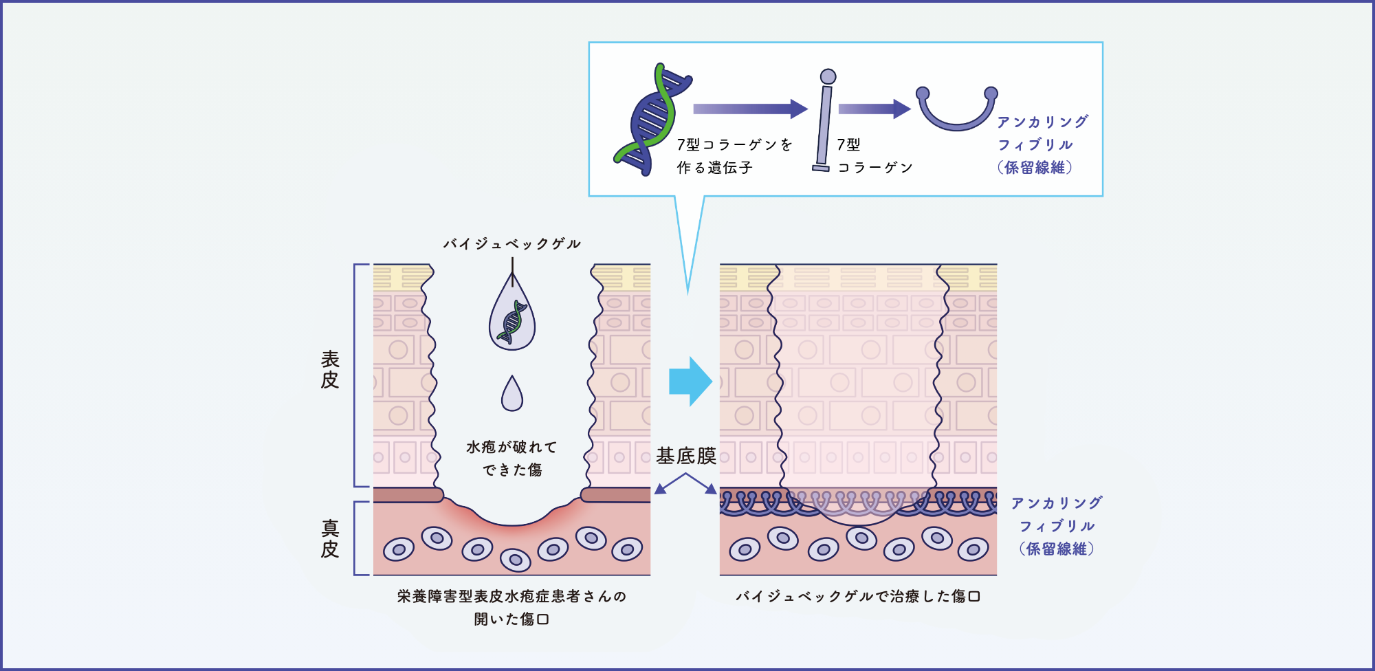 バイジュベックゲルの投与によって傷口が治癒するイメージ図